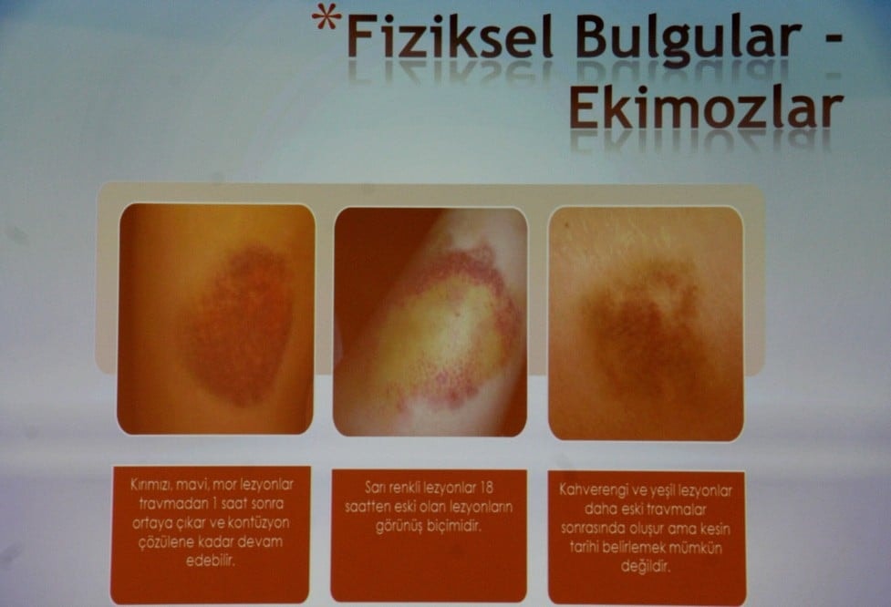 Çocuk Hukuku Konulu Eğitim Semineri - 83